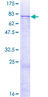 12.5% SDS-PAGE Stained with Coomassie Blue.